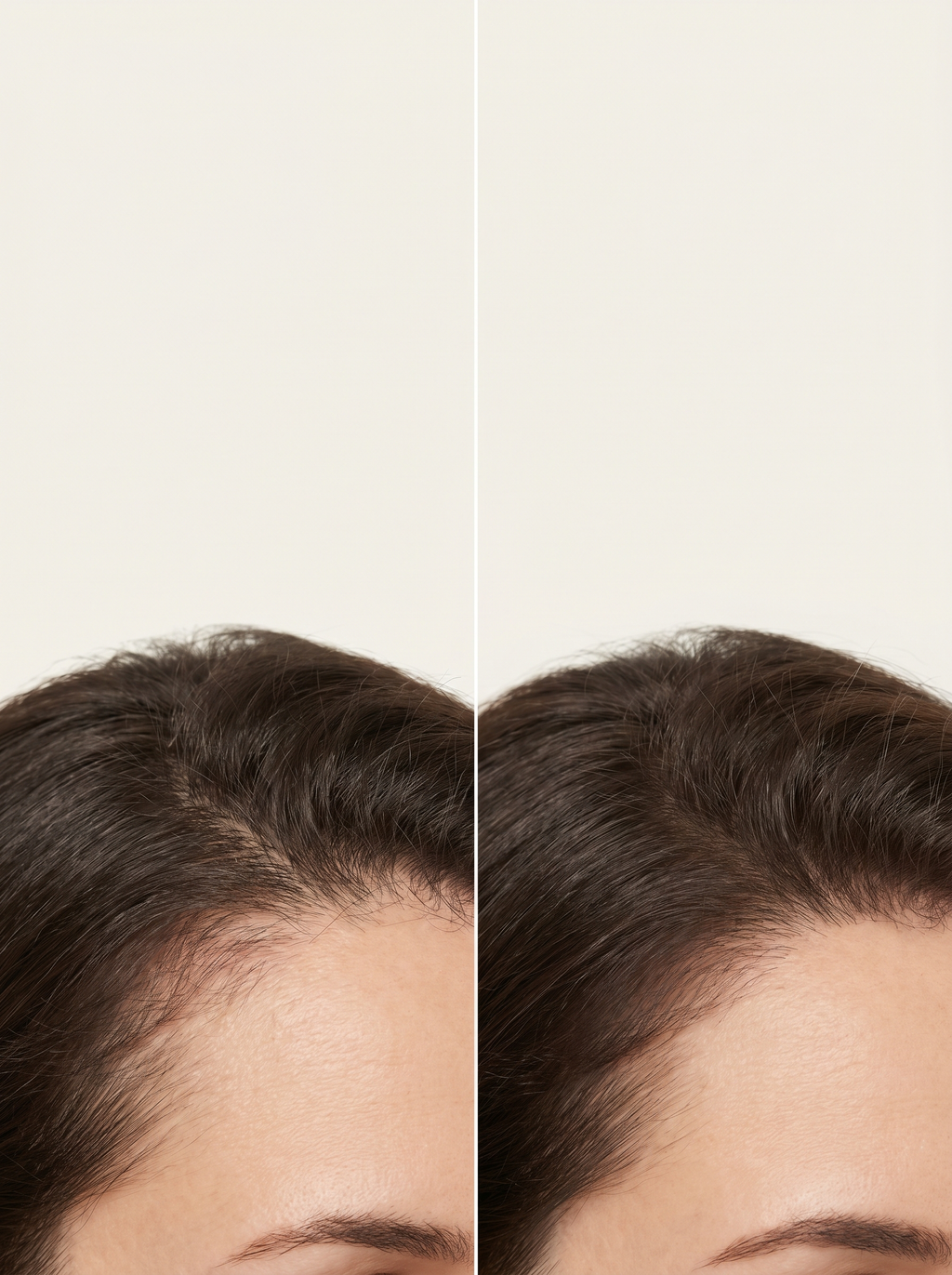 Topical hair serum RU58841 + GHK-CU 30ml